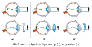 Göz kusurları miyopi (a), hipermetropi (b), astigmatizm (c)